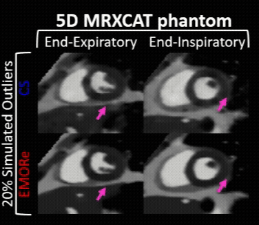 Motion-robust 5D MRI GIF